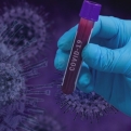 Megtalálták, miért nem fertőz meg egyes embereket az új típusú koronavírus