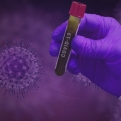 Rossz hír a koronavírus örökítőanyagáról